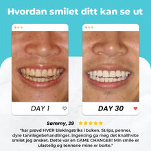 Load image into Gallery viewer, U-formet elektrisk tannbørste