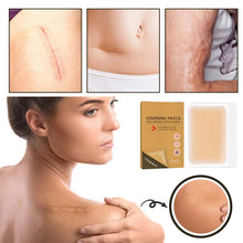 Load image into Gallery viewer, Skin Invisible Concealer Patch