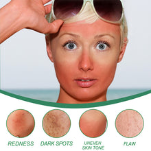 Load image into Gallery viewer, Color Correcting Treatment Cream