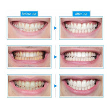 Load image into Gallery viewer, Perfect Teeth Whitening Pen