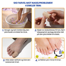 Load image into Gallery viewer, Sopplapper mot negler