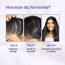 Load image into Gallery viewer, Avansert hårvekst roll-on serum