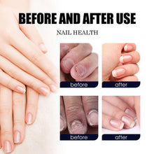 Load image into Gallery viewer, Nail Care Solution