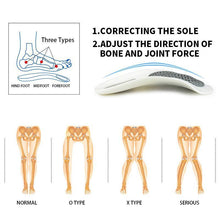 Load image into Gallery viewer, Magoloft™ Foot Orthotics Plantar Fasciitis Arch Support Insoles