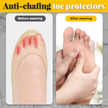 Load image into Gallery viewer, Silicone Anti-Friction Toe Protector (10pcs)