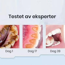 Load image into Gallery viewer, Super Probiotic-6 tannkrem