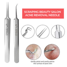 Load image into Gallery viewer, Professional Facial Blackhead Remover Tweezers