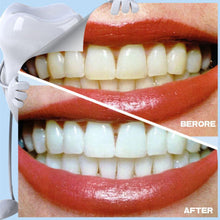 Load image into Gallery viewer, Teeth Whitening Stain Eraser
