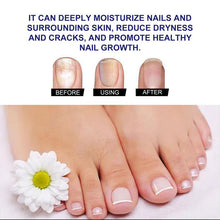 Load image into Gallery viewer, Nail Care Solution