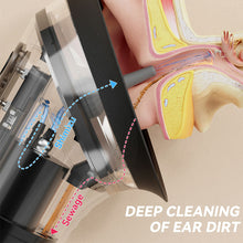 Load image into Gallery viewer, Electric Ear Wax Removal