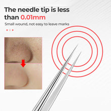 Load image into Gallery viewer, Professional Facial Blackhead Remover Tweezers