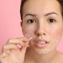 Load image into Gallery viewer, Invisible Acne Removal Pimple Patch