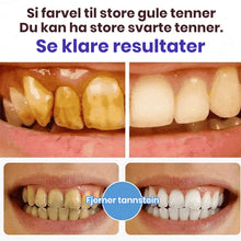 Load image into Gallery viewer, Super Probiotic-6 tannkrem