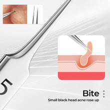Load image into Gallery viewer, Professional Facial Blackhead Remover Tweezers