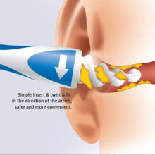 Load image into Gallery viewer, Ear Wax Removal Tool