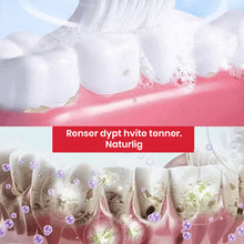 Load image into Gallery viewer, Super Probiotic-6 tannkrem