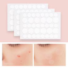 Load image into Gallery viewer, Invisible Acne Removal Pimple Patch