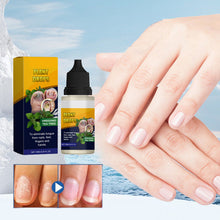 Load image into Gallery viewer, Nail Care Solution
