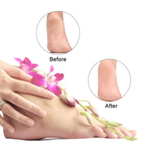 Load image into Gallery viewer, Pedicure Foot File, 2 Pack