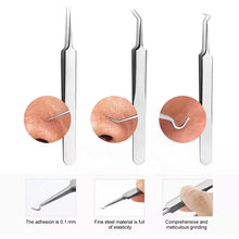 Load image into Gallery viewer, Professional Facial Blackhead Remover Tweezers