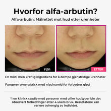 Load image into Gallery viewer, Intensivt misfargingsserum