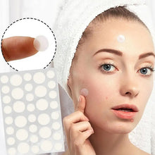 Load image into Gallery viewer, Invisible Acne Removal Pimple Patch