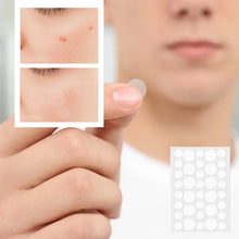 Load image into Gallery viewer, Invisible Acne Removal Pimple Patch