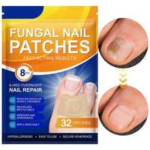 Load image into Gallery viewer, Fungal Nail Patches